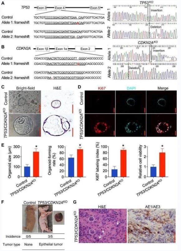 Knockout of TP53/CDKN2A promotes neoplastic transformation in human normal gastroesophageal junction organoids.