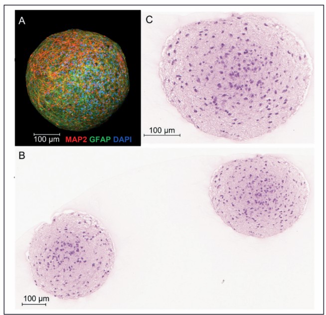 Image analysis of human iPSC-derived 3D neural spheroids.