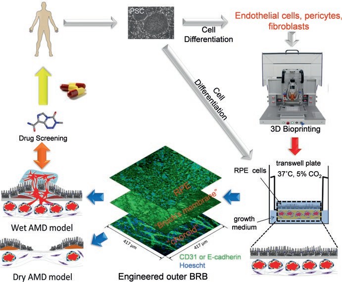 Age-related macular degeneration model derived iPSC cells for drug discovery.