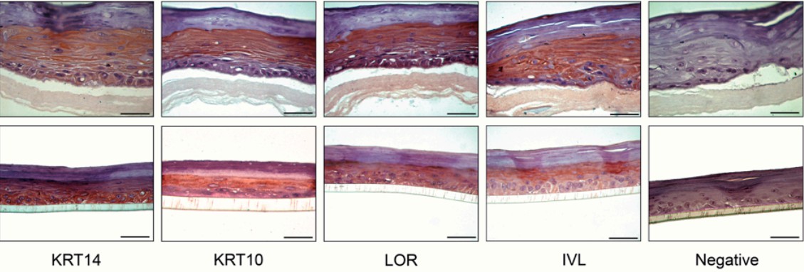 Immunohistochemistry of human skin tissue model. (Camarena, 2020)