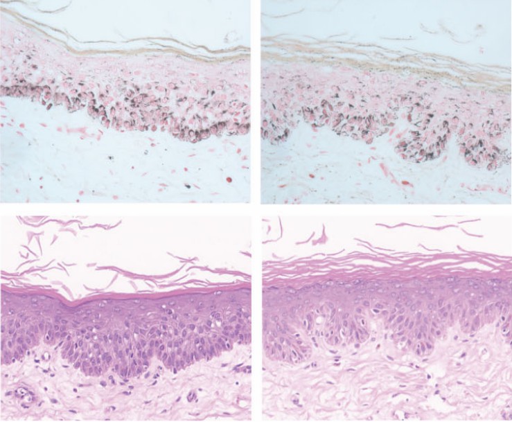 Histological detection of melanogenesis. (Zhang, 2022)