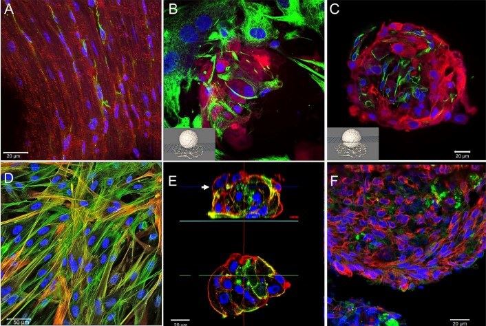 2D and 3D spheroid cardiac model. (Beauchamp, 2020)