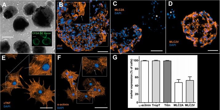 iPSC-derived cardiomyocytes. (Rojas, 2017)