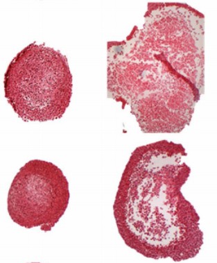 3D spheroid morphology. (Tutty, 2022)