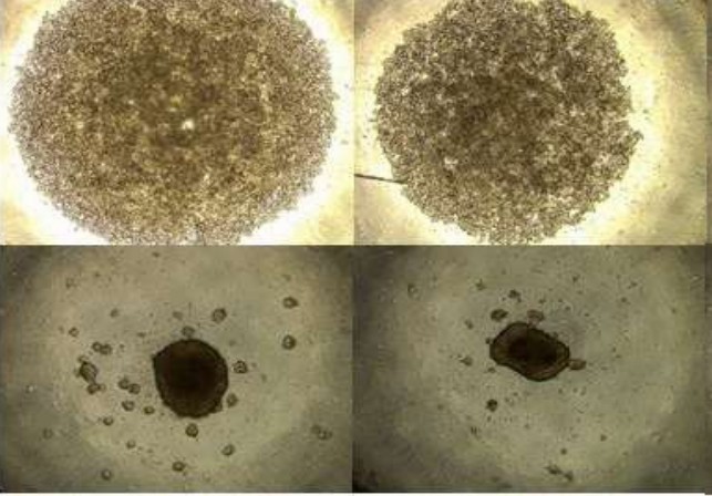 Spheroid formation. (Wallace, 2020)