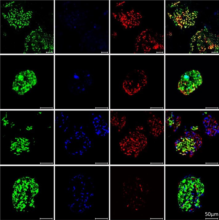 3D culture of pancreatic endocrine cell. (Liu, 2020)