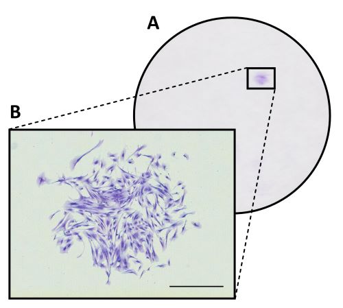 Representative image of a small macroscopic colony of CFU-F. (Berger, 2020)