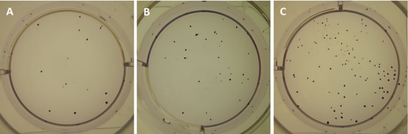 Colony forming with graded concentrations of cancer cell lines seeded on soft agar. (Rajendran & Jain, 2018)