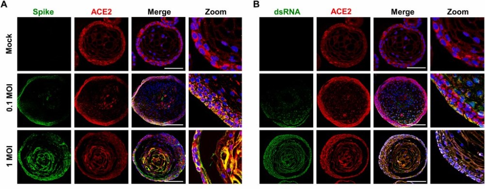 Immunofluorescent staining images of tonsillar epithelial organoids infected with different virus titers. (Kim, 2022)