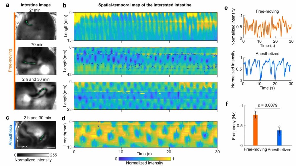 2D Trans-illumination Intestine Projection Imaging of intestinal motility in mice. (Wang, 2021)