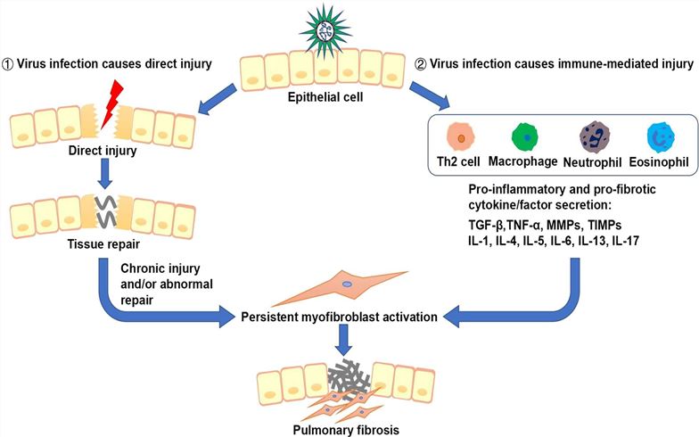 Two key pathways of virus-induced injury and pulmonary fibrosis. (Huang, et al., 2021)