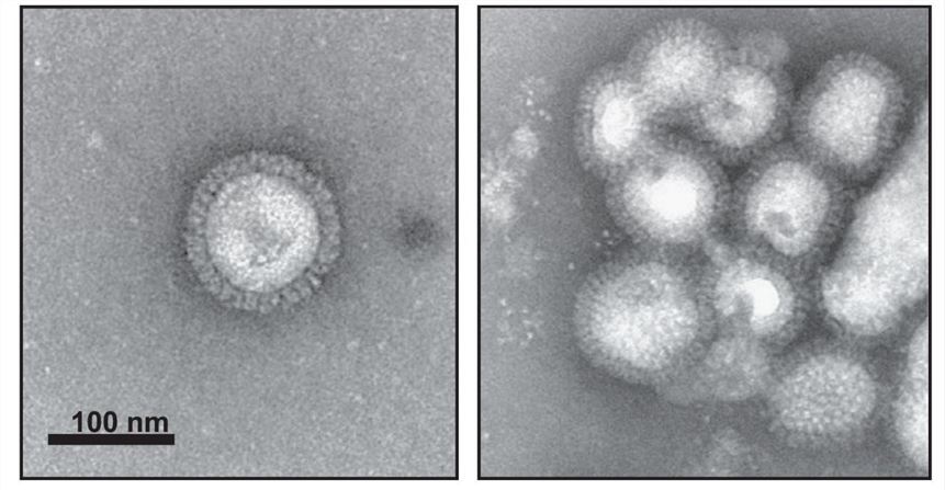 EM images of influenza VLPs from Sf9 cells using baculovirus expression. (Pushko, et al., 2020)