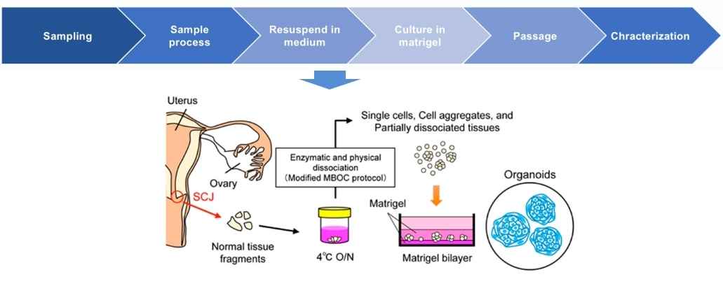 Workflow for the establishment of cervical organoids.