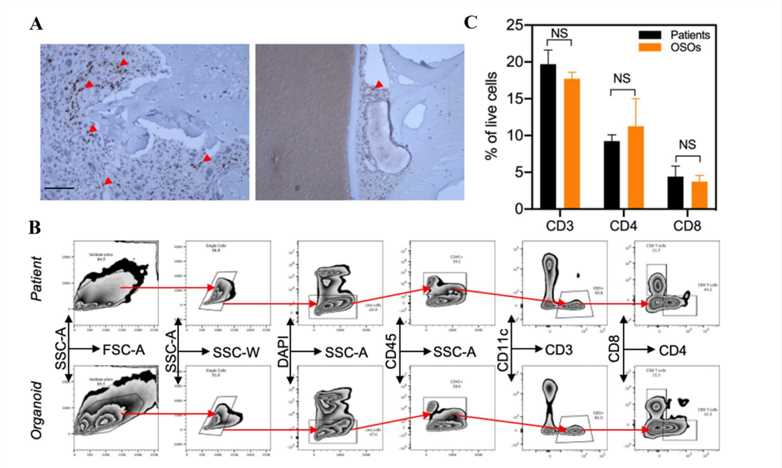 T cells are present in cancer organoids as they are distributed in tumor tissue.