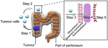 Peritoneal Metastatic Colorectal Cancer Organoid Models