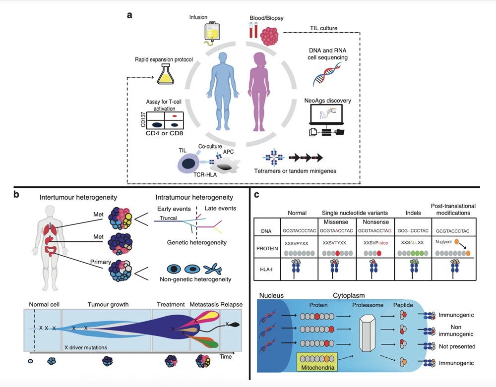 Fig.1：Using Tumour-infiltrating Lymphocytes in Autologous Cell Transfer. 