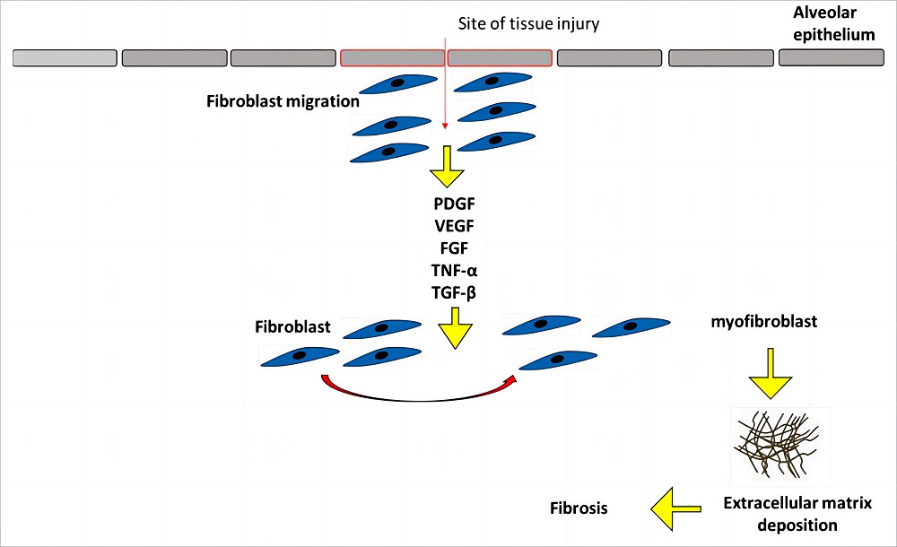 Fig.1 Characterization of fibrosis. (Antar, Samar A., et al., 2023)