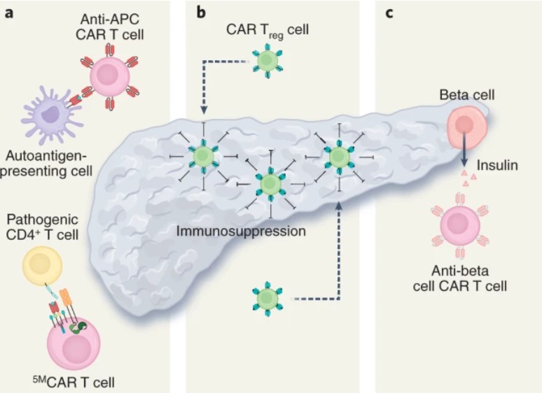 Fig.2 CAR-T strategies for diabetes. (Aghajanian, et al., 2022)