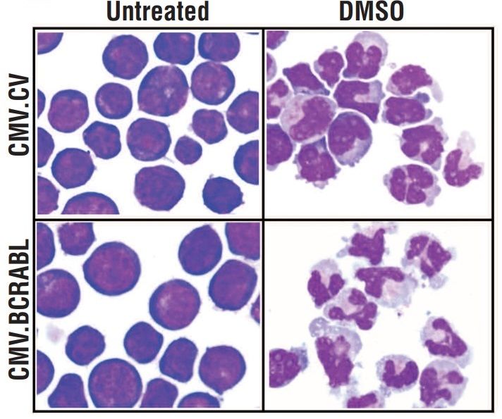 Fig.1 Cell differentiation of HL60 cells transduced with control vector or BCR-ABL. (Engler, et al., 2011）