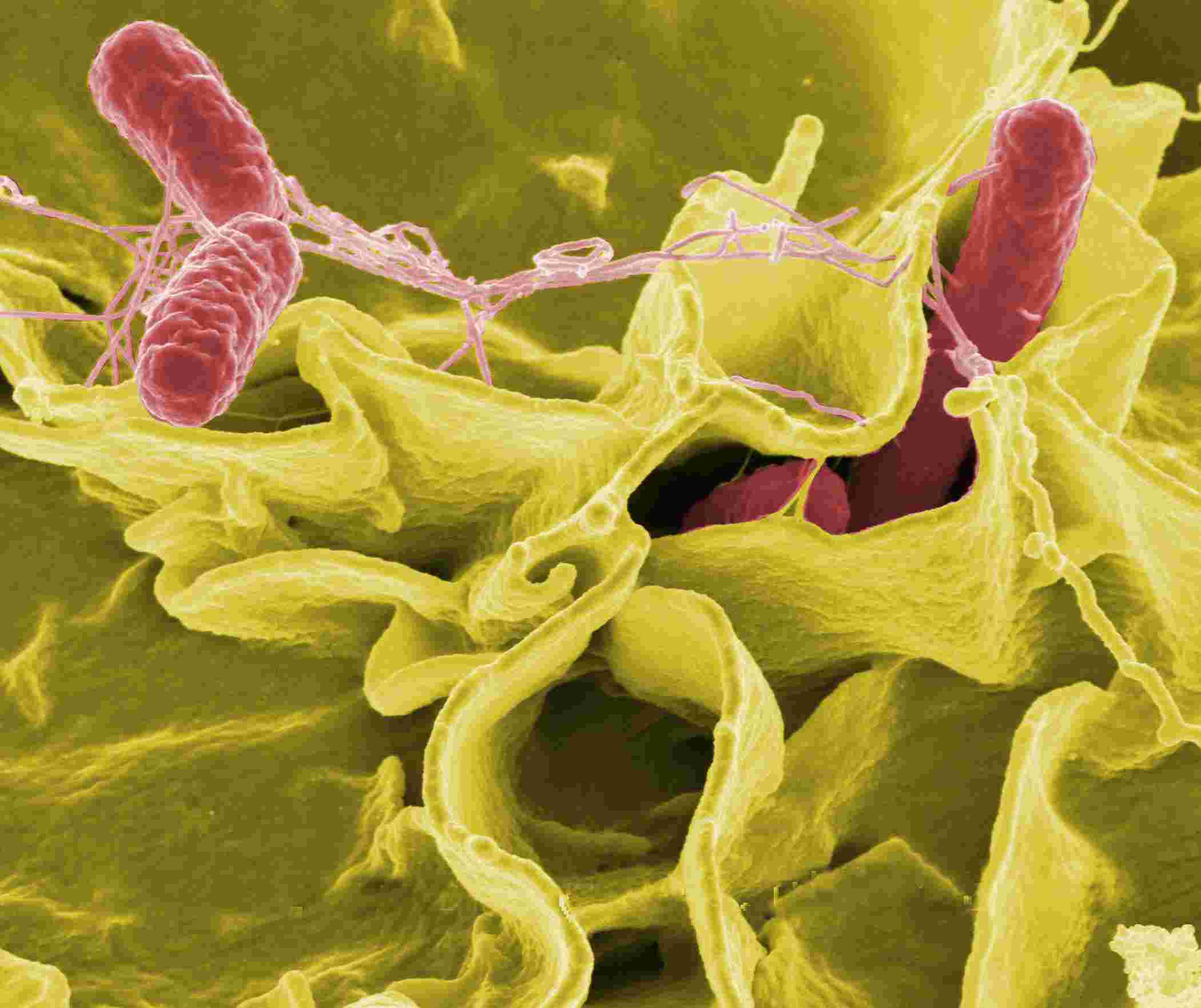 Fig.1 Salmonella Typhimurium (red) invading cultured human cells (NIAID, Public Domain, https://commons.wikimedia.org/wiki/File:SalmonellaNIAID.jpg)