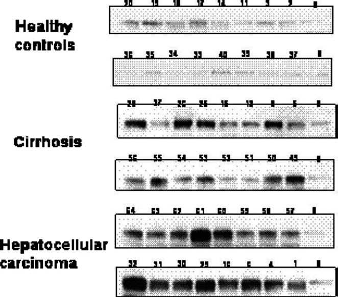 Fig.2 Immunoblot analysis of GP73. (Xia, et al., 2019)