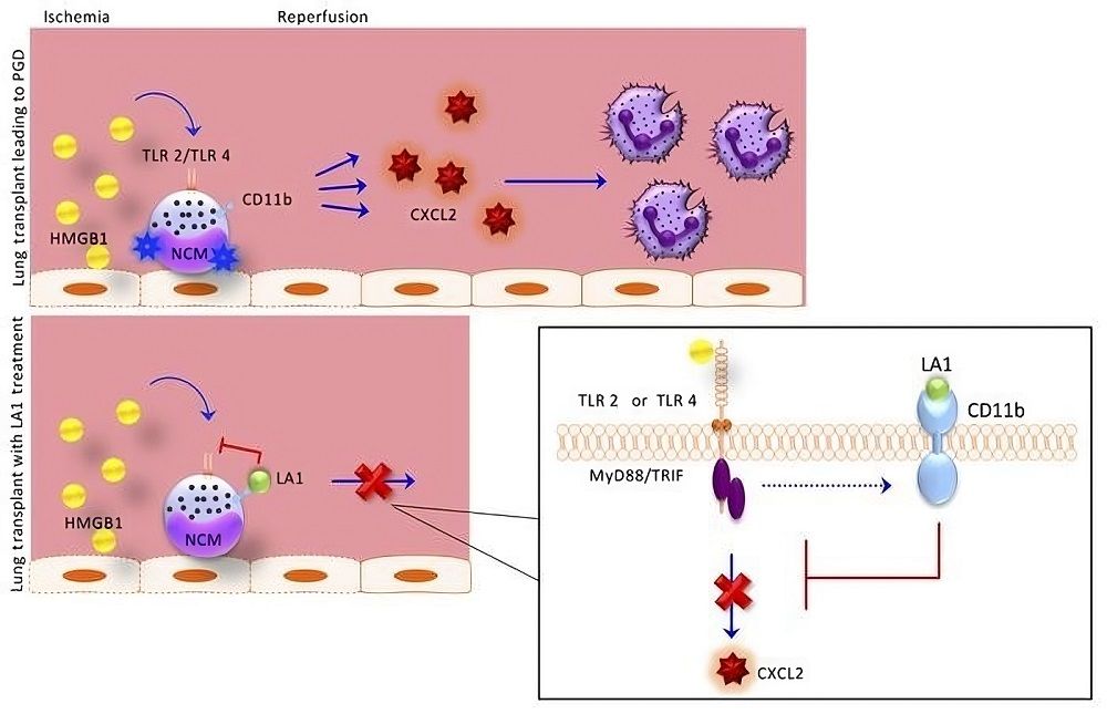 Fig.2 CD11b acts as a molecular brake to prevent neutrophil recruitment by nonclassical monocytes following lung transplantation. (Querrey, et al., 2022)