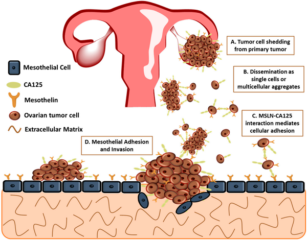 Fig.2 Regulation of peritoneal metastasis of ovarian tumors by mesothelin. (Hilliard, 2018)