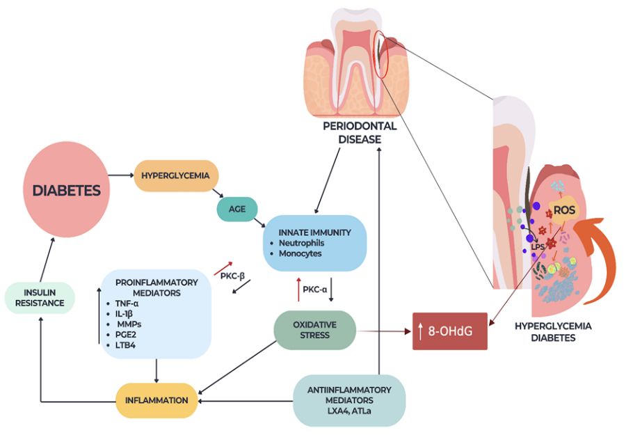 Fig.2 A schematic diagram reveals the periodontal disease-diabetes-OHdG relationship. (Goriuc, et al., 2024)