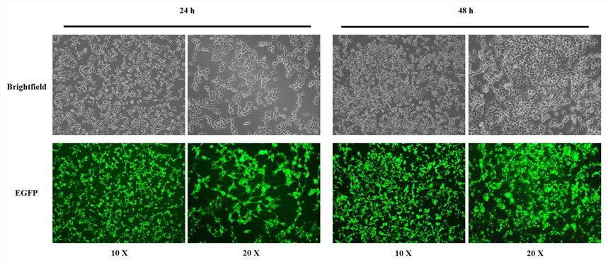 HEK293T cells transfected with CD63-EGFP plasmid at 24 and 48 hours. (Creative Biolabs Original)