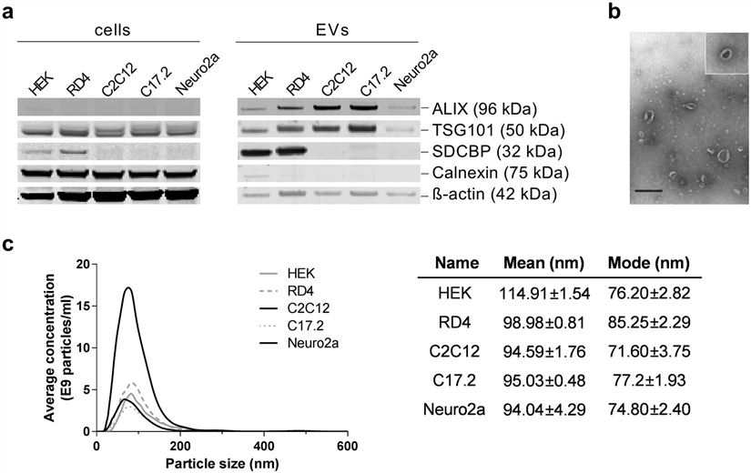 Extracellular vesicles Characterization. (Sork, et al., 2018)