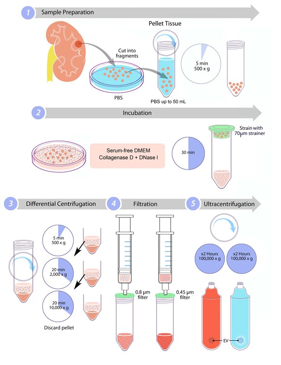 Fig.2 EV isolation from kidney. (Zieren, et al., 2020)