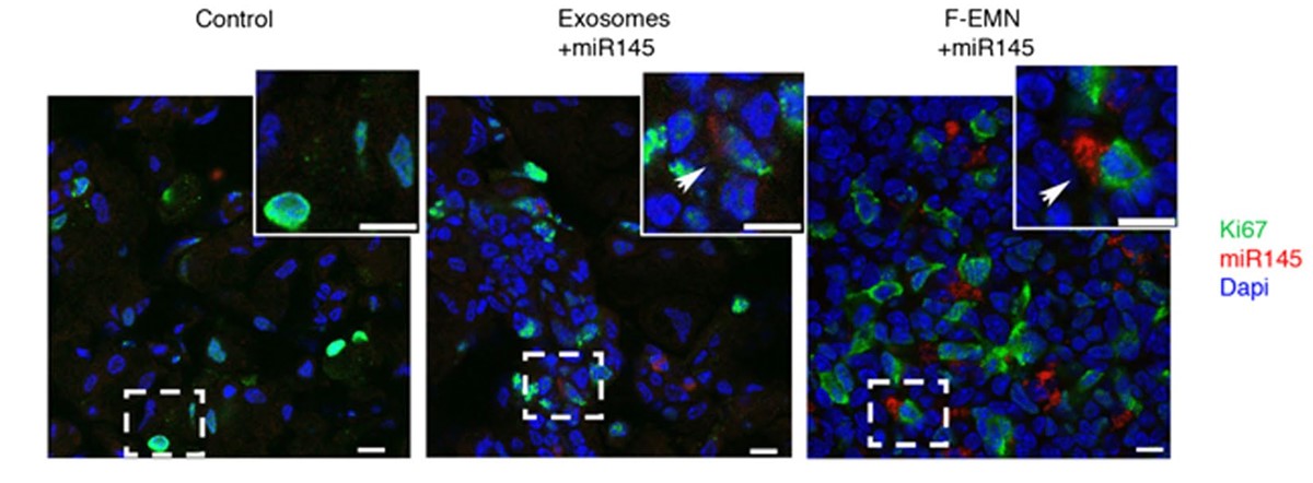 Fig. 1 Confocal microscopy images of miRNAs delivering to lung tumors by naive exosomes and EMN. (Vázquez-Ríos, et al., 2019)