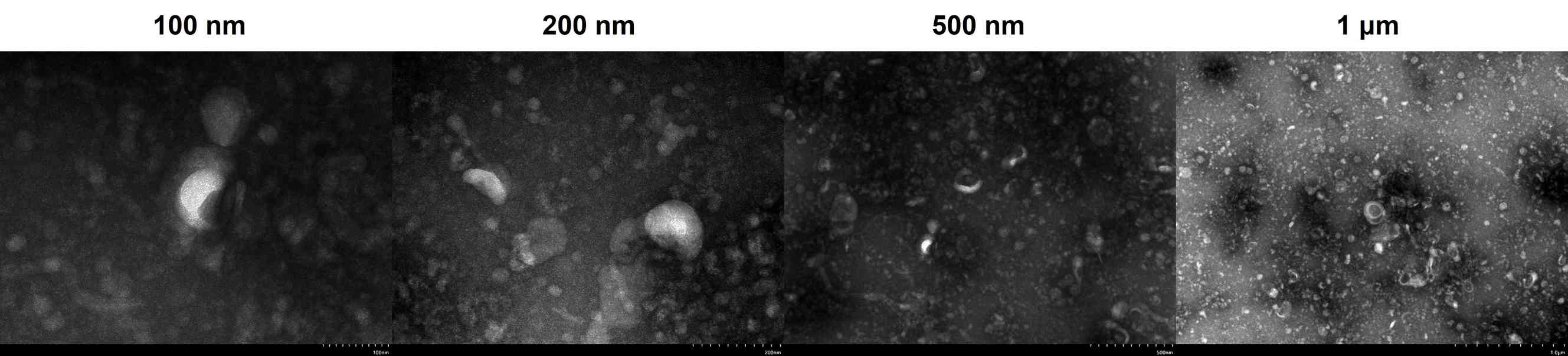 Fig.1. Exosome TEM characterization at different magnifications. (Creative Biolabs)