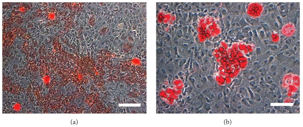 Fig. 1 Differentiation potential of SF-MSCs. (Jorgenson, et al., 2018)