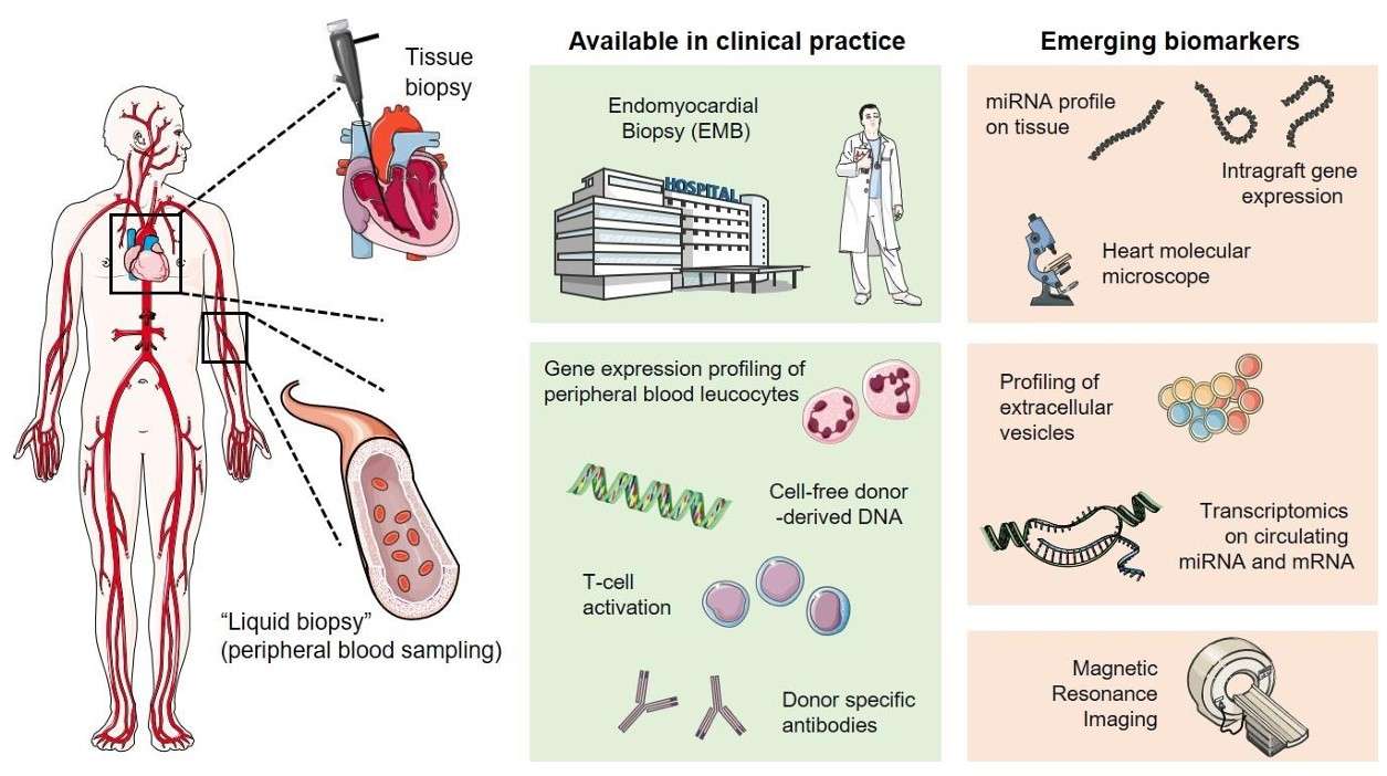 Fig.1 Cardiac Allograft Rejection Monitoring: Invasive vs. Non-Invasive. (Giarraputo, et al., 2021)