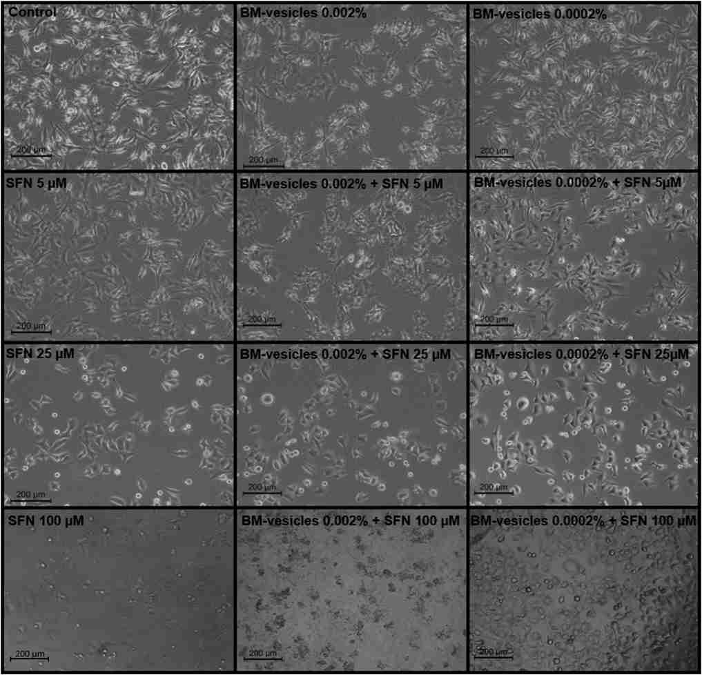 Phase contrast microscopy images of cells under different conditions. (Yepes-Molina, et al., 2021)