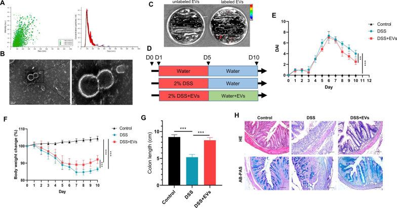 Exosomes derived from Clostridium butyricum inhibit acute colitis. (Liang, et al., 2022)