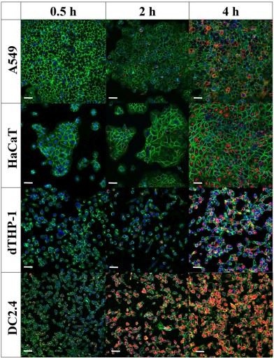 Streptococcus pneumoniae-derived exosomes are taken up by cells in a time-dependent manner