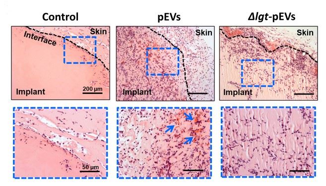 Streptococcus pneumoniae-derived exosomes induced host cell recruitment.