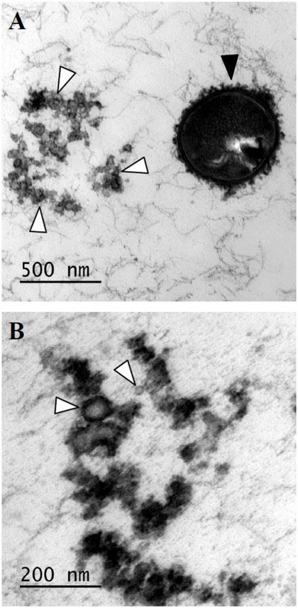 Transmission electron micrograph of vesicles from Streptococcus suis. (Haas, et al., 2015)