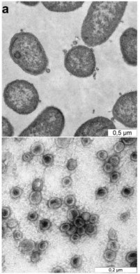 Evidence for Bacteroides vulgatus-derived exosome-like vesicles from bulging of the outer membrane