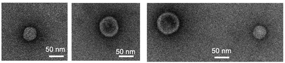 Transmission electron microscopy of Escherichia coli-derived exosomes