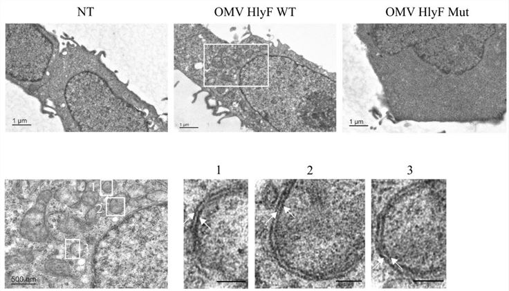 Transmission electron microscopy observation of double-membrane autophagosomes in HlyF-positive Escherichia coli-derived exosomes-treated cells.