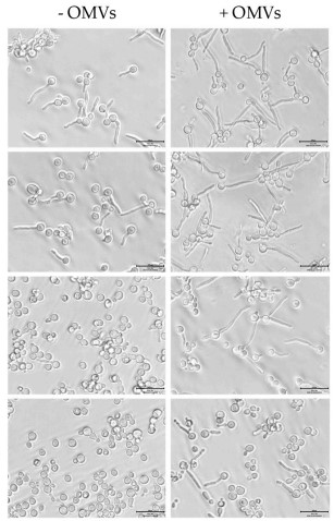 Moraxella catarrhalis-derived exosomes favored yeast retention of filaments