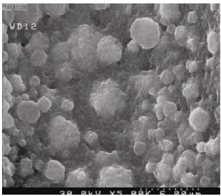 Electron micrographs of Haemophilus influenzae-derived exosomes