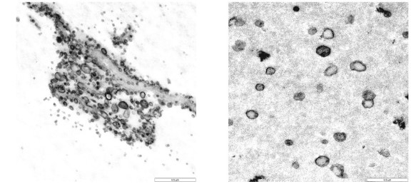 TEM of exosomes derived from Acinetobacter baumannii and from mutant strains of Acinetobacter baumannii lacking LPS synthesis