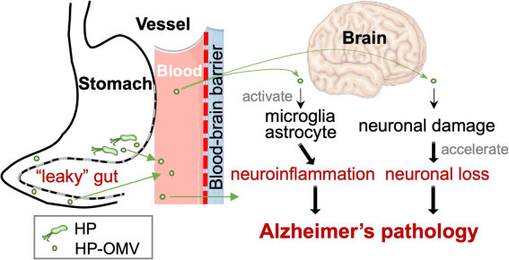 Hypothesized role of Helicobacter pylori-derived outer membrane vesicles in Alzheimer's disease. (Park, et al., 2022)