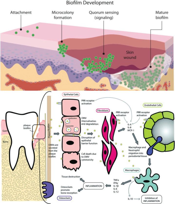 Porphyromonas gingivalis outer membrane vesicles. (Zhang, et al., 2020)