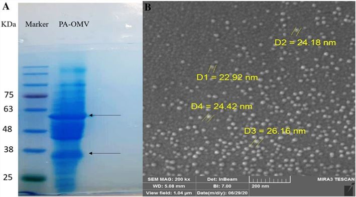 Outer membrane vesicles isolated from Pseudomonas aeruginosa. (Zare Banadkoki, et al., 2022)