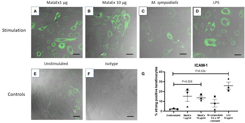 Malassezia-derived exosomes enhanced ICAM-1 expression. (Vallhov, et al., 2020)